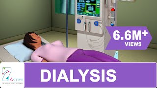 Procedure of DIALYSIS [upl. by Assenal]