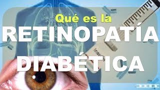 ¿Qué es la RETINOPATÍA diabética Causas Diagnóstico clínica oftalmoscopía Parte 1 [upl. by Edlun]