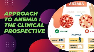 Approach to Anemia  The clinical Prospective [upl. by Ttehc501]