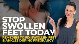 Swollen Feet Pregnancy FIX STOP Pregnancy Edema Fast [upl. by Joceline]