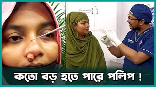 নাকের পলিপাস বাস্তবে দেখতে কেমন এবং এর চিকিৎসা কি  Dr Bashudeb Kumar Saha [upl. by Suissac292]