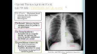 introduction à la radio pulmonaire [upl. by Lohrman43]