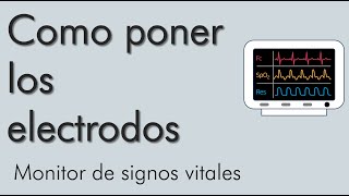 Disposición de los electrodos  monitor de signos vitales  video 1 [upl. by Veal]