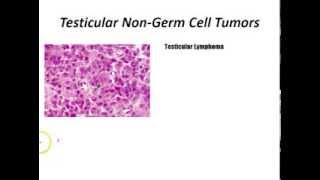 USMLE Review  Repro Pathology [upl. by Kresic580]