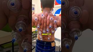 This is an extremely strange procedure 😲viral satisfying weird shorts [upl. by Bail472]