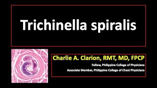 Trichinella spiralis [upl. by Meletius]