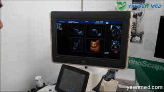 Sonoscape S40 4D Doppler Color Ultrasound S40 Demo  YSENMED  YUESEN MED [upl. by Snell]