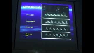 Fetal doppler  Dr Hussein Abo El Makarem [upl. by Talya]