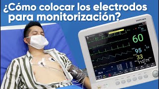 ¿Cómo colocar los electrodos para monitorización [upl. by Notrom]