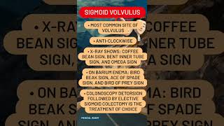 Sigmoid volvulus [upl. by Indnahc]