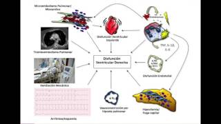 Síndrome de Bajo Gasto Cardiaco Derecho  Definición y Fisiopatología Parte 1 [upl. by Fontes846]