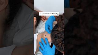 Hyperhidrosis Treatment  Botox For Excessive Under Arm Sweating  hyperhidrosis botoxtreatment [upl. by Hardden]