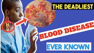 How to Control Leukemia  The Most Deadliest Blood Cancer [upl. by Enilegna]