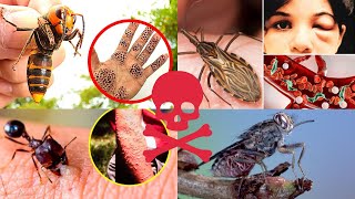 Los 5 insectos más peligros del mundo 2024 [upl. by Cole]