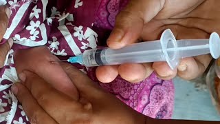 Ceftazidim 250mg Tazid injection im injection Video 24 Ep 61 By Injection Tips [upl. by Thalassa]