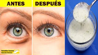 Eliminar Arrugas Y Líneas Debajo De Los Ojos Con Sólo Esta Mezcla Y Verás Más Jóvenes [upl. by Ankney]