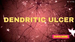 Dendritic ulcer  ULCER  OPHTHALMOLOGY USMLE  NEETPG  INICET  NEETPG MBBS SCIENCEPARADISE [upl. by Einafpets]