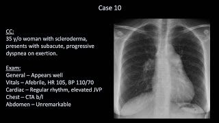 How to Interpret a Chest XRay Lesson 10  Self Assessment Part 2 [upl. by Aruat358]