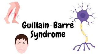 Understanding GuillainBarre Syndrome [upl. by Nisa]