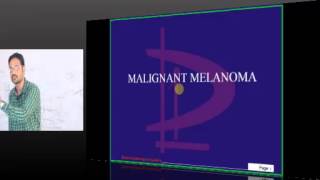 NEETPG Coaching Surgery Topic 01 Malignant Melanoma Part 01 [upl. by Eltsirk]