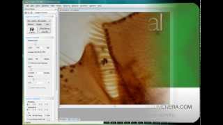 Lumeneras INFINITY ANALYZE Software Tutorial Dynamic Zoom Function [upl. by Porcia]