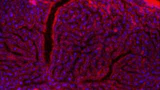 S aureus Toxins LukED and HlgAB Cause Vascular Leakage [upl. by Thatcher]