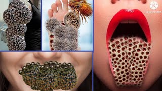 ASMRsatisfying sea burnacles worms Trypophobia temoval [upl. by Loux]