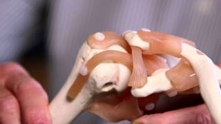 Treating Stiff Joints [upl. by Karlen]