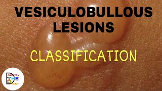 VESICULOBULLOUS LESIONS CLASSIFICATION [upl. by Ainna749]