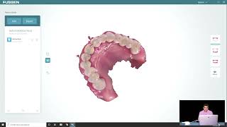 🦷Escaner intraoral FUSSEN S600🦷Manejo del software parte 1 [upl. by Fu]