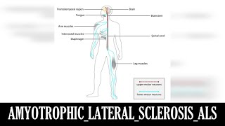 AMYOTROPHIC LATERAL SCLEROSIS ALS [upl. by Trinetta]