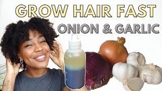 ONION AND GARLIC hair oil for RAPID hair growth and REDUCE HAIR FALL [upl. by Kcirdahs303]