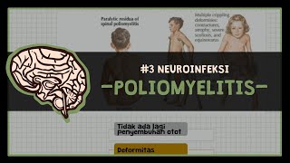 Poliomyelitis  3 NEUROINFECTIOUS DISEASE [upl. by Radbourne]