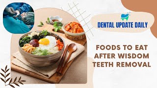 Soft Foods To Eat After Wisdom Teeth Removal [upl. by Anelac]