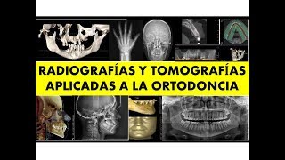 quotRADIOGRAFÍAS EXTRAORALES Y TOMOGRAFÍA CONE BEAM EN ORTODONCIAquot por el Dr Luis Arroyo [upl. by Ratcliff]