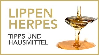 Lippenherpes  Tipps und Hausmittel  Dr Petra Bracht  Wissen Gesundheit [upl. by Annekim]