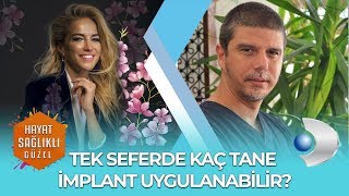 TEK SEFERDE KAÇ TANE İMPLANT UYGULANABİLİR DR TANSU ERAKMAN [upl. by Anidnamra]