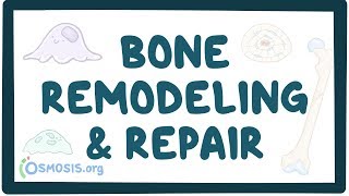 Bone remodeling and repair [upl. by Nickola]