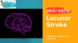 Must Know Lacunar Stroke [upl. by Seravaj]