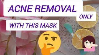 Acne removal only with this mask [upl. by Ariahs203]