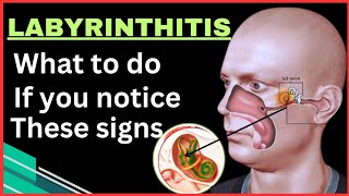 What is Labyrinthitis  Unraveling Causes Symptoms  Inner Ear Wellness happyhealingaz [upl. by Yrrem]