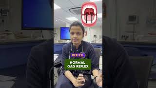 Understanding the Gag Reflex What It Reveals About Your Body  Medical Explained [upl. by Ahsratal545]