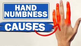 Expert Reveals MindBlowing Facts About Numbness amp Tingling In Fingers [upl. by Nylhtiak847]