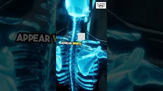 What Is an X Ray Machine  Intro to Biomedical Instrumentation Medical Imaging Device BioMedEng [upl. by Klein]