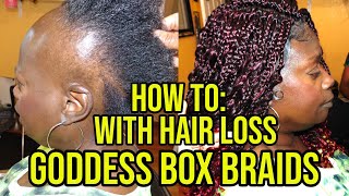 HOW TO CROCHET GODDESS BOX BRAIDS FOR ALOPECIA HAIRLOSS SHORT amp THIN HAIR [upl. by Felicio]