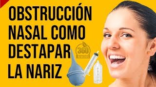 Para La OBSTRUCCION NASAL Te Digo Como Destapar La Nariz Con El Lavado Nasal Con Suero Fisiologico [upl. by Lauzon]