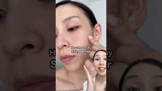 How I repaired my skin barrier in 1 week [upl. by Fiske]