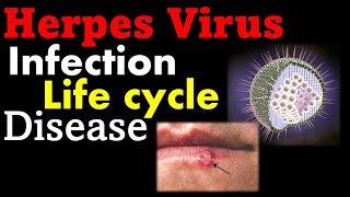 Herpes virus infection and treatment [upl. by Bluh835]