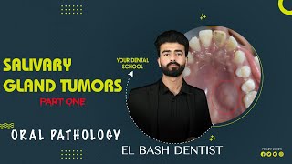 benign salivary gland tumors  oral pathology  عزت شومان [upl. by Takashi]