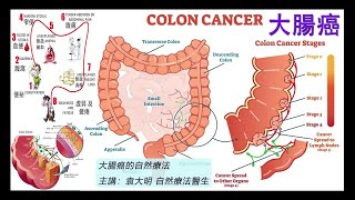 《自然療法與你》 EP723  大腸癌的自然療法 [upl. by Harsho]